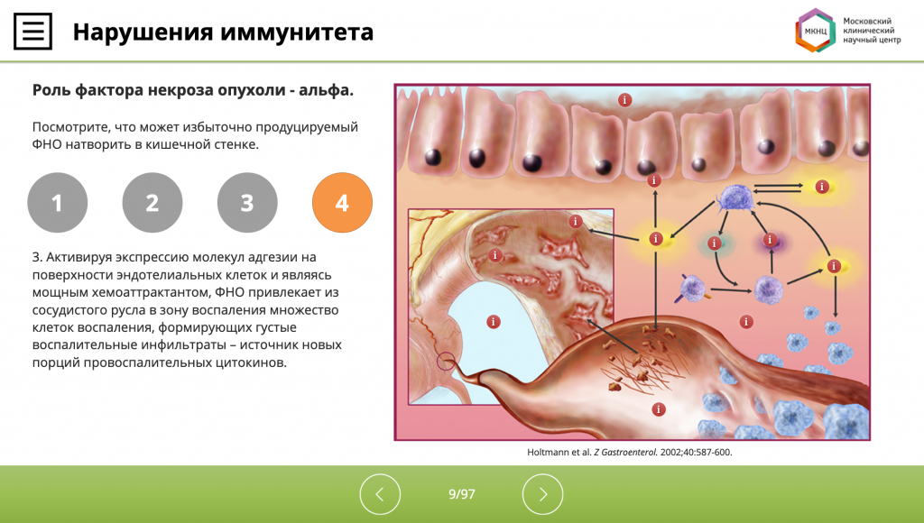 Скриншот из курса по морфологической диагностике воспалительных заболеваний кишечника