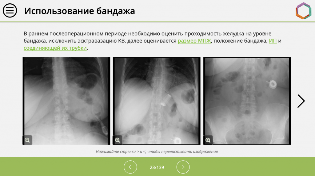 Скриншот из курса по рентгенологической диагностике в бариатрической хирургии